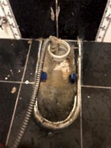 pimaş tıkanıklığı açma